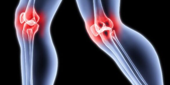 Osteoarthritis des Knies