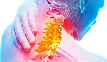 Anzeichen einer Osteochondose der Halsspalte
